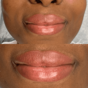 Lip Neutralization