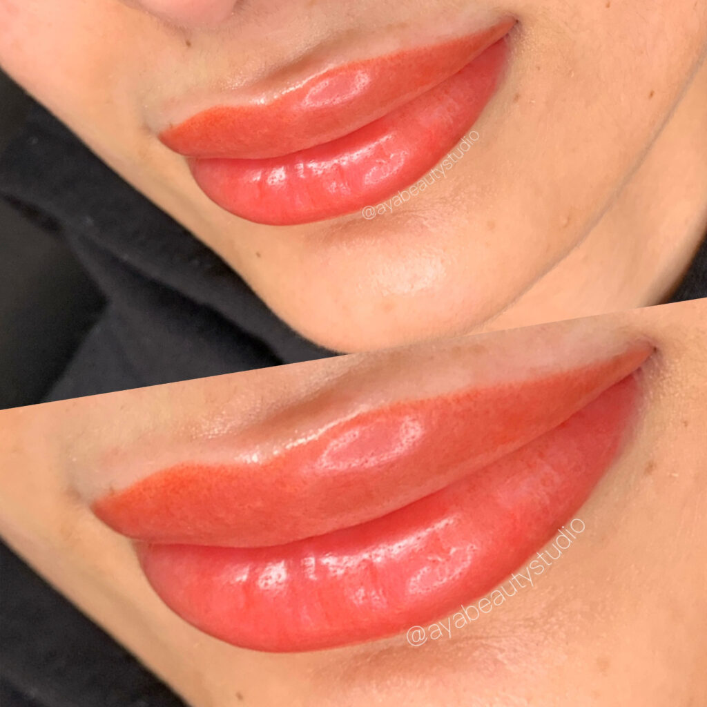 Lip Blush | Lip Neutralization